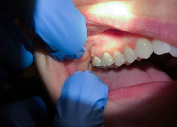 Best Emergency Treatment for Jaw Pain or Injury in Centralia, IL