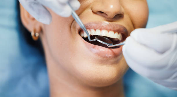 Best Dental Abscess Treatment in Centralia, IL